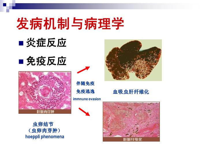 【醫學PPT課件】日本血吸蟲病 華中科技大學傳染病學教學課件第13頁