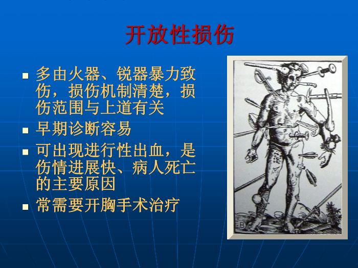 【醫學PPT課件】第27章 胸部損傷  蚌埠醫學院胸外科王祖義第7頁