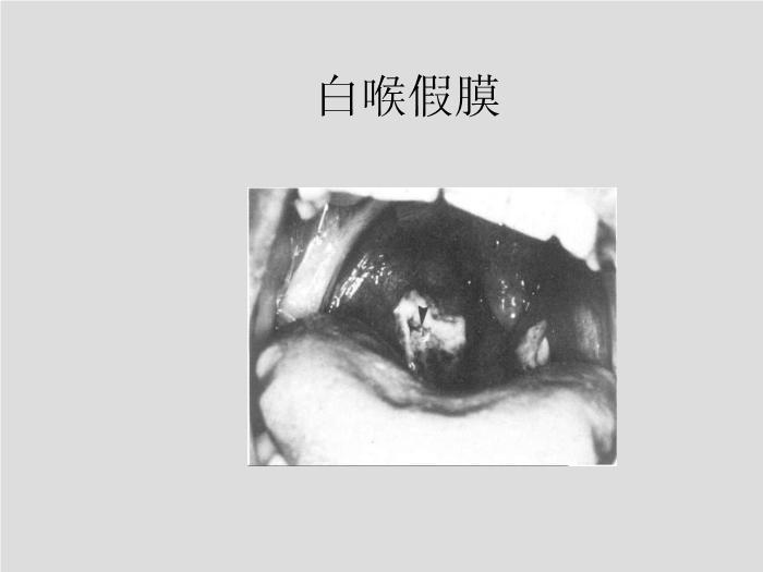 【醫學PPT課件】第12章 棒狀桿菌屬 北華大學醫學院第9頁
