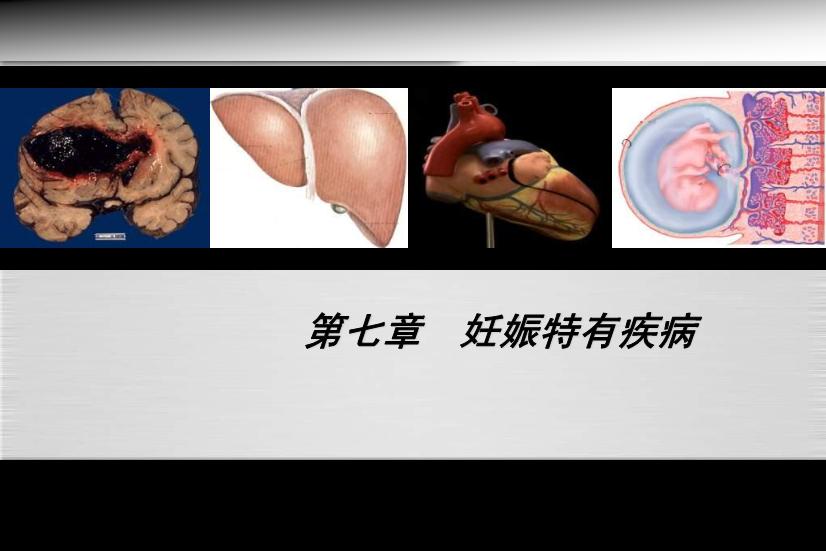 【醫學PPT課件】妊娠期高血壓疾病 人衛版教學PPT課件第3頁