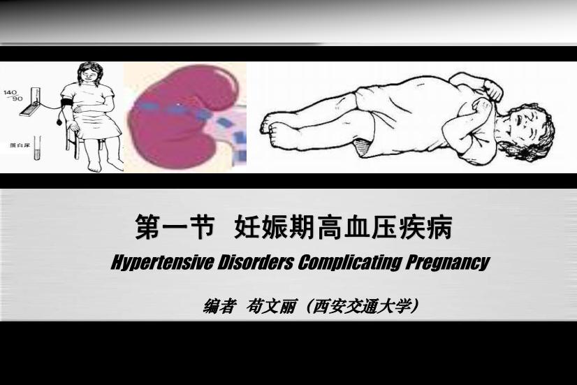 【醫學PPT課件】妊娠期高血壓疾病 人衛版教學PPT課件第4頁