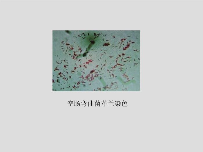 【醫學PPT課件】第11章 彎曲菌屬與螺桿菌屬 廣州醫學院吳愛武第10頁