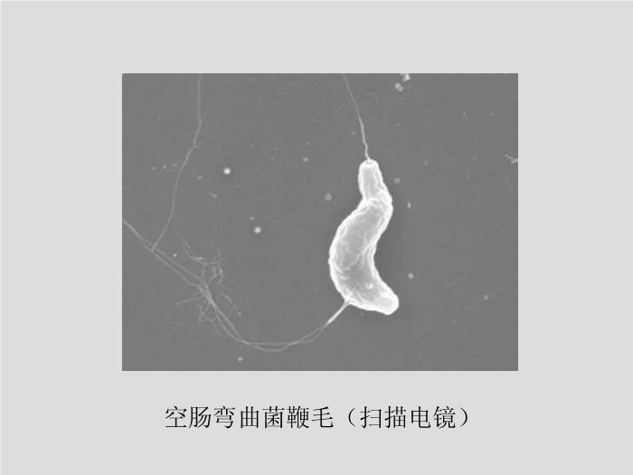 【醫學PPT課件】第11章 彎曲菌屬與螺桿菌屬 廣州醫學院吳愛武第11頁