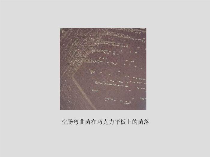 【醫學PPT課件】第11章 彎曲菌屬與螺桿菌屬 廣州醫學院吳愛武第15頁