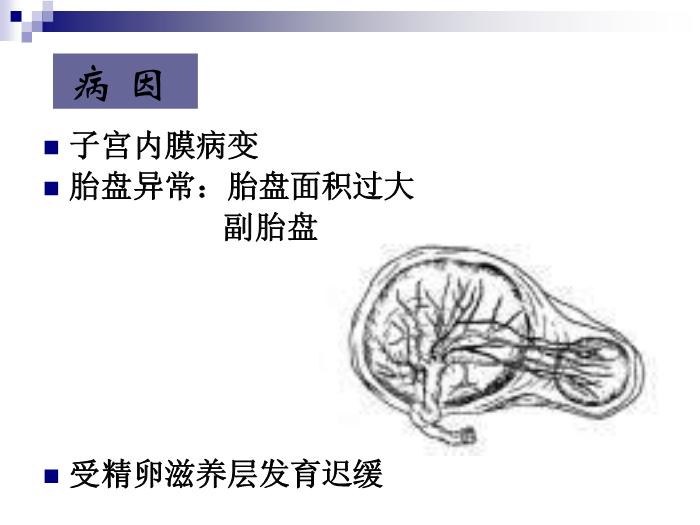 【醫學PPT課件】前置胎盤復旦大學精品課件第5頁