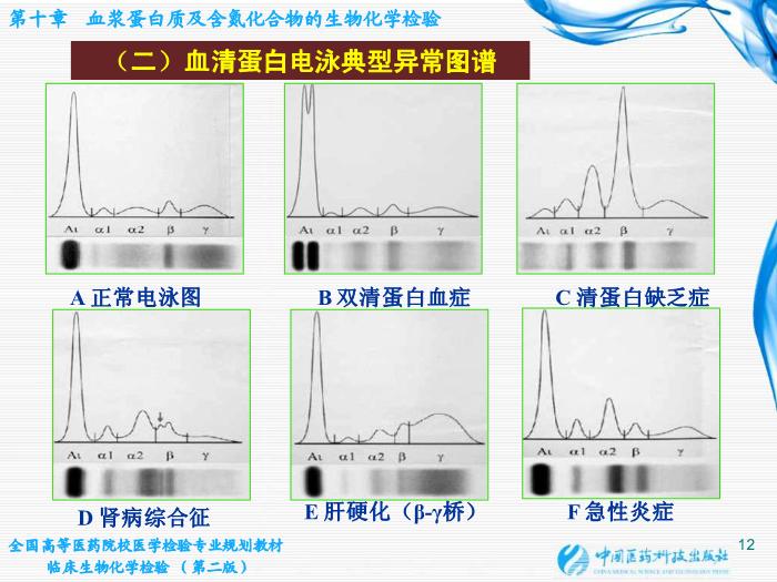 【醫學PPT課件】第10章  血漿蛋白質及含氮化合物的生物化學檢驗第12頁