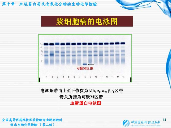 【醫學PPT課件】第10章  血漿蛋白質及含氮化合物的生物化學檢驗第14頁