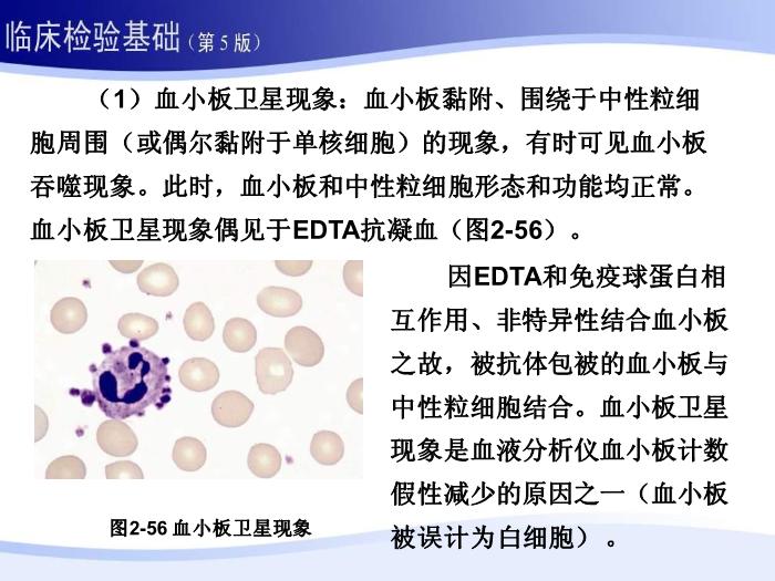 【醫學PPT課件】第二章 血液一般檢驗 06 血小板部分第12頁