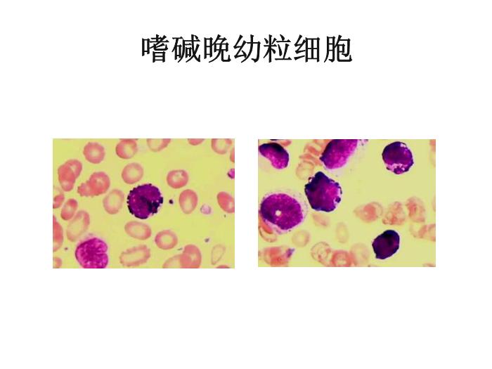 【醫學PPT課件】第八版診斷學 白細胞圖譜第10頁