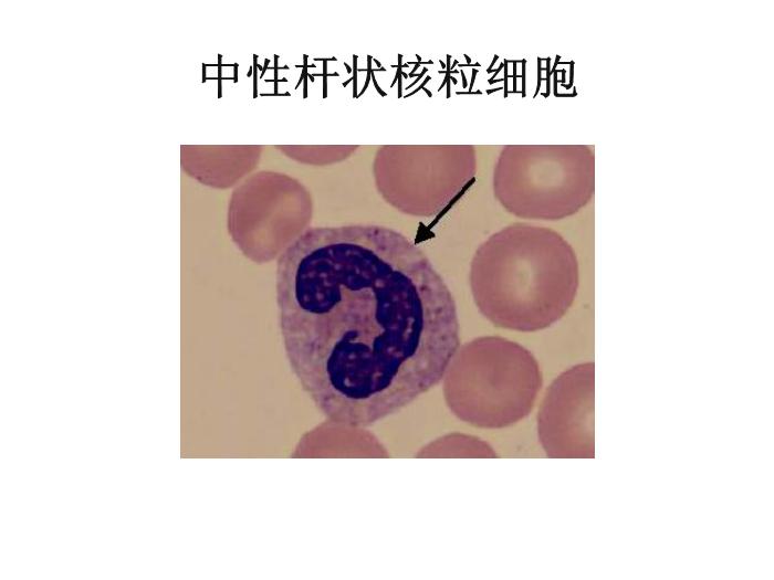 【醫學PPT課件】第八版診斷學 白細胞圖譜第11頁