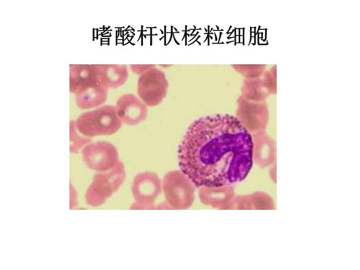 【醫學PPT課件】第八版診斷學 白細胞圖譜第12頁