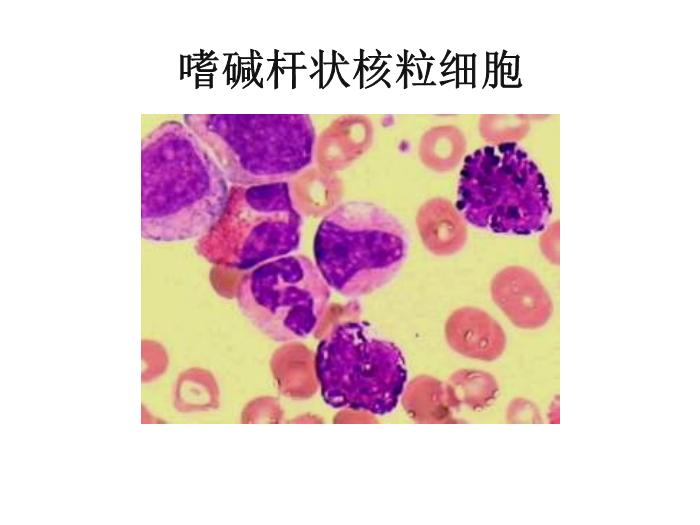 【醫學PPT課件】第八版診斷學 白細胞圖譜第13頁