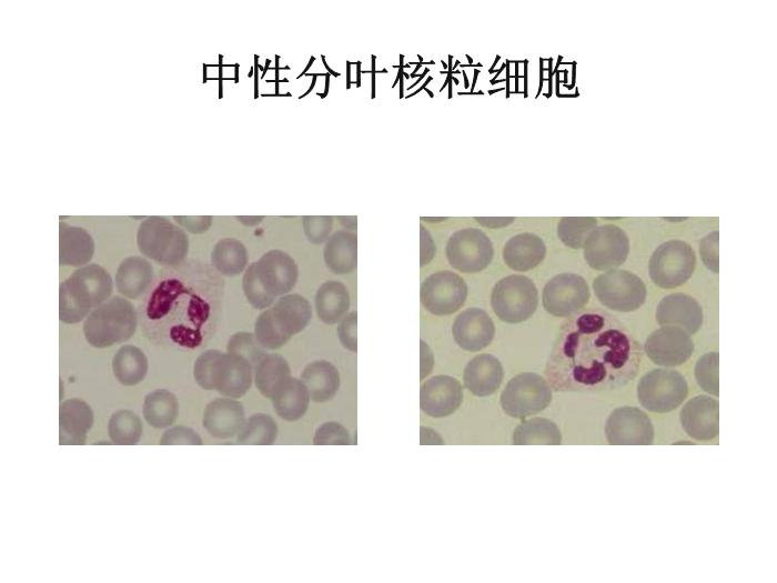 【醫學PPT課件】第八版診斷學 白細胞圖譜第14頁