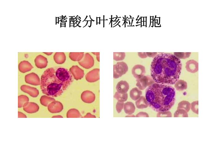 【醫學PPT課件】第八版診斷學 白細胞圖譜第15頁