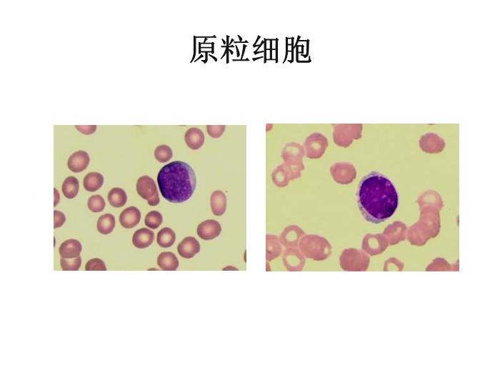 【醫學PPT課件】第八版診斷學 白細胞圖譜第3頁