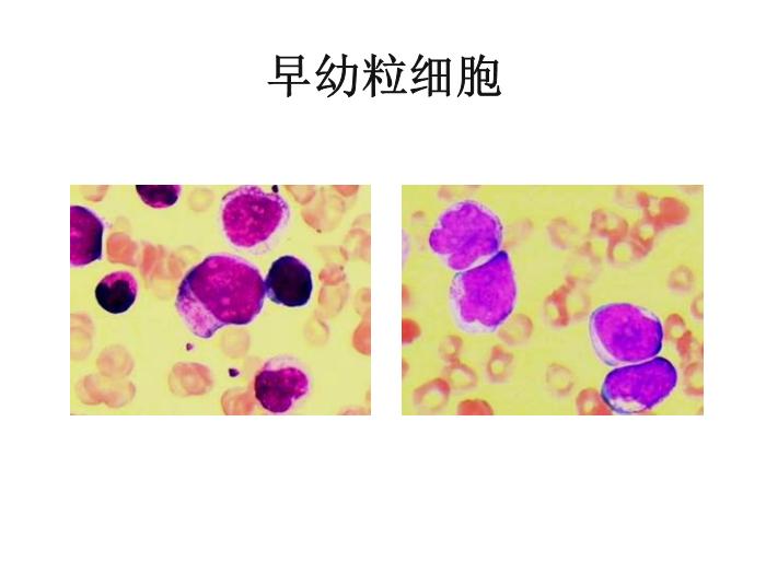 【醫學PPT課件】第八版診斷學 白細胞圖譜第4頁