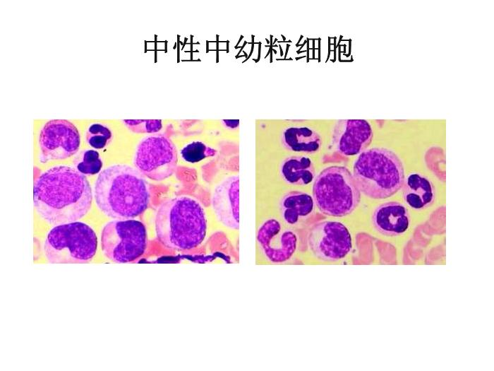 【醫學PPT課件】第八版診斷學 白細胞圖譜第5頁