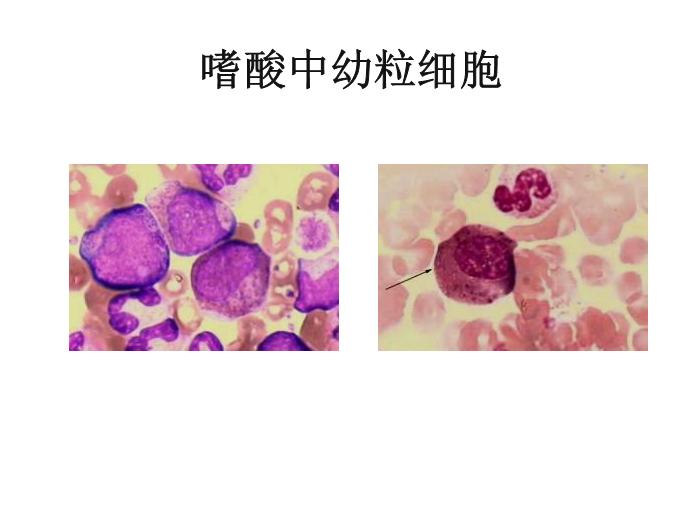 【醫學PPT課件】第八版診斷學 白細胞圖譜第6頁