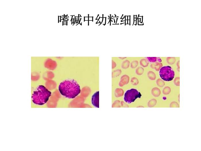 【醫學PPT課件】第八版診斷學 白細胞圖譜第7頁