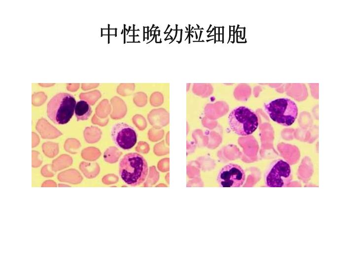 【醫學PPT課件】第八版診斷學 白細胞圖譜第8頁