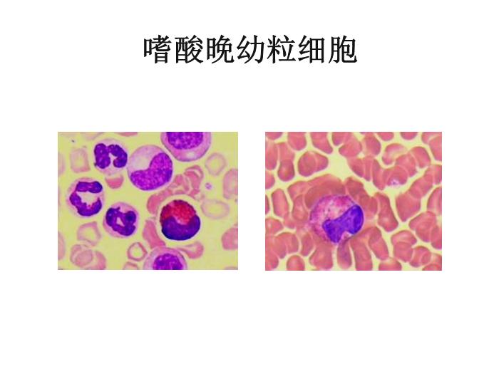 【醫學PPT課件】第八版診斷學 白細胞圖譜第9頁