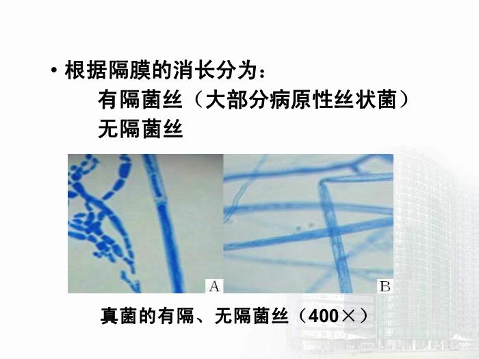 【醫學PPT課件】第35章 真菌學總論 醫學微生物學教學課件第13頁