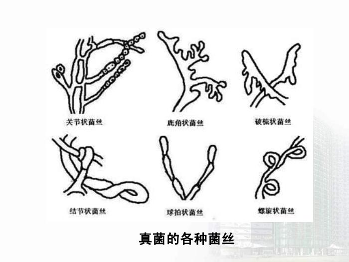 【醫學PPT課件】第35章 真菌學總論 醫學微生物學教學課件第15頁