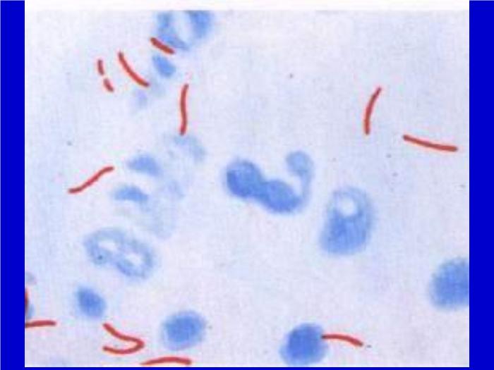 【醫學PPT課件】肺結核 pulmonary tuberculosis(TB)河南醫科大學一附院呼吸內科 王靜第4頁