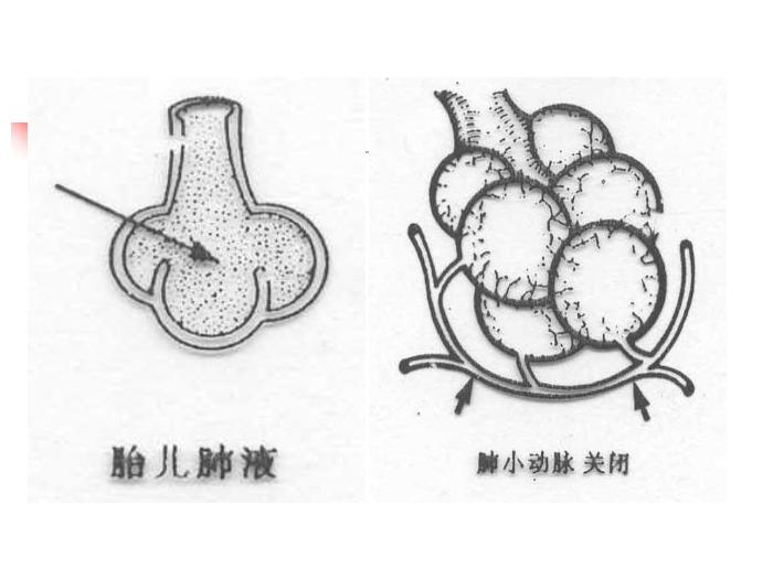 【醫學PPT課件】新生兒窒息復蘇培訓 石門縣人民醫院新生兒科第13頁