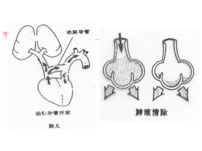 【醫學PPT課件】新生兒窒息復蘇培訓 石門縣人民醫院新生兒科第14頁