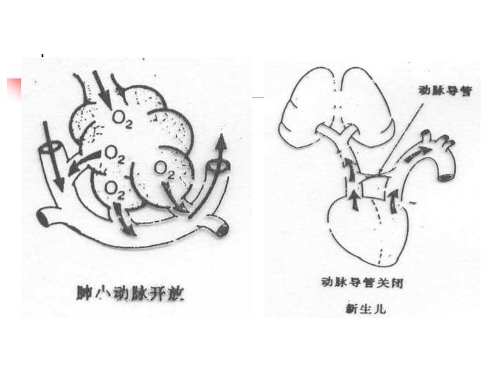 【醫學PPT課件】新生兒窒息復蘇培訓 石門縣人民醫院新生兒科第15頁
