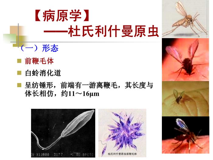 【醫學PPT課件】黑熱病 西安交通大學傳染病學教學課件第4頁
