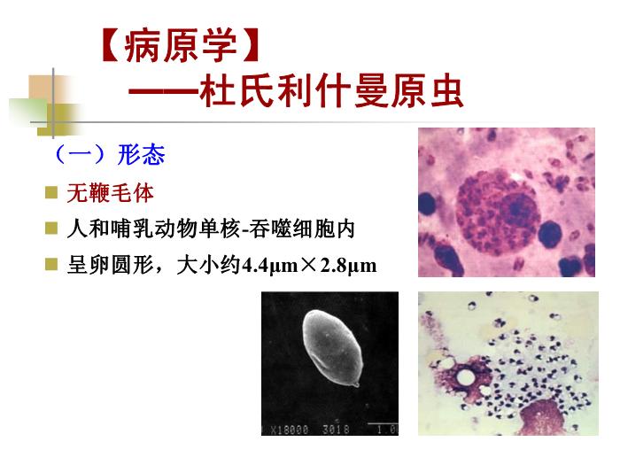 【醫學PPT課件】黑熱病 西安交通大學傳染病學教學課件第5頁