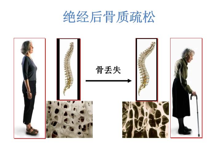 【醫學PPT課件】合理應用激素補充治療維護更年期婦女的健康HRT 北京協和醫院第9頁