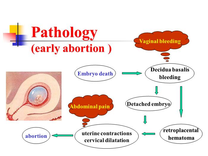 【醫學PPT課件】流產abortion(課件)第11頁