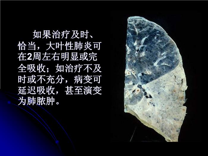 【醫學PPT課件】肺部炎癥影像診斷_南大一附院影像科PPT課件第9頁