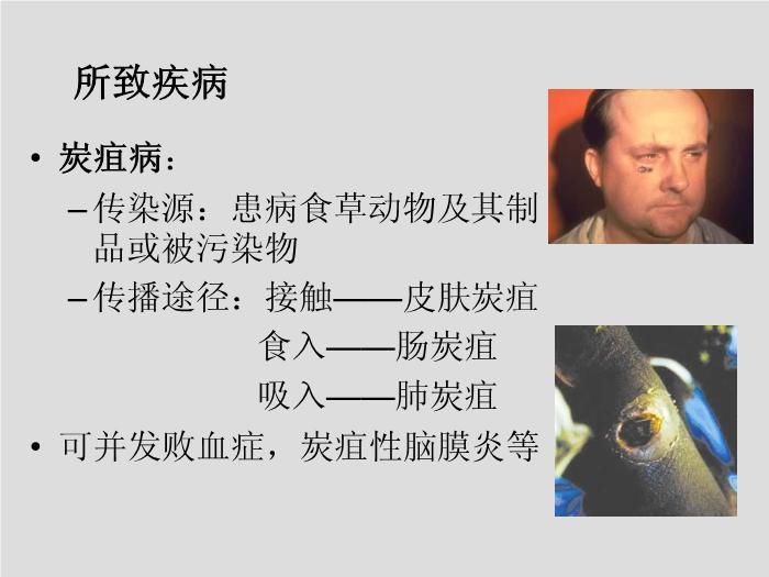【醫學PPT課件】第13章 其他需氧革蘭陽性桿菌 蚌埠醫學院  第5頁