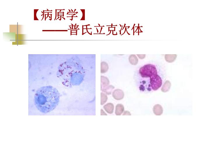【醫學PPT課件】流行性與地方性斑疹傷寒 西安交通大學傳染病學教學課件第6頁