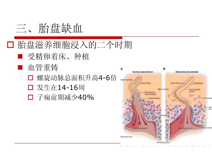 【醫學PPT課件】妊娠高血壓疾病 復旦大學附屬婦產科醫院第10頁
