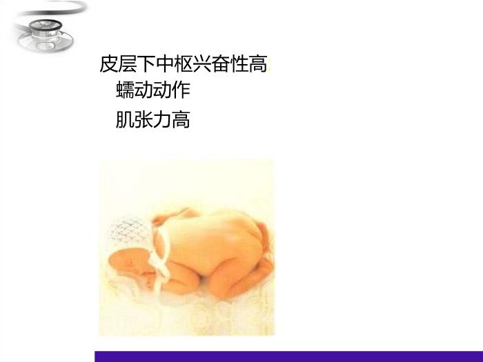 【醫學PPT課件】兒童神經心理發育 八年制兒科學PPT課件第7頁