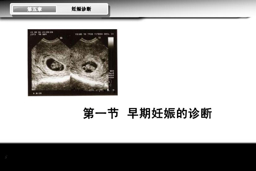 【醫學PPT課件】妊娠診斷 人衛版教學PPT課件第5頁