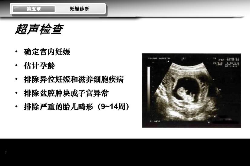 【醫學PPT課件】妊娠診斷 人衛版教學PPT課件第8頁