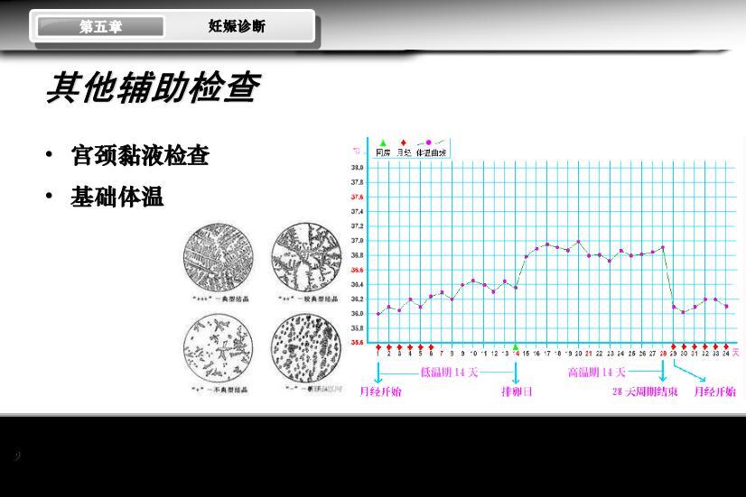 【醫學PPT課件】妊娠診斷 人衛版教學PPT課件第9頁