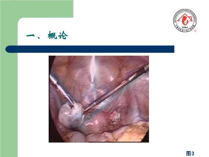 【醫學PPT課件】卵巢腫瘤  復旦大學附屬婦產科醫院預覽圖（3）