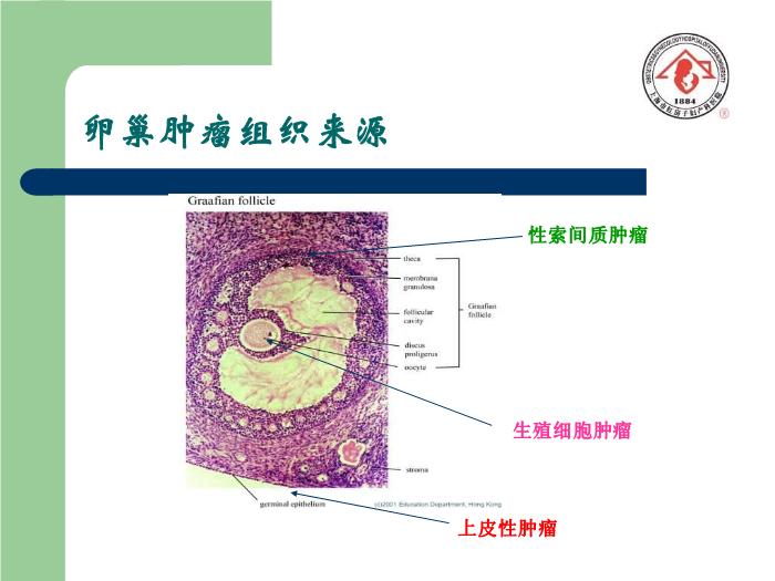 【醫學PPT課件】卵巢腫瘤  復旦大學附屬婦產科醫院預覽圖（5）
