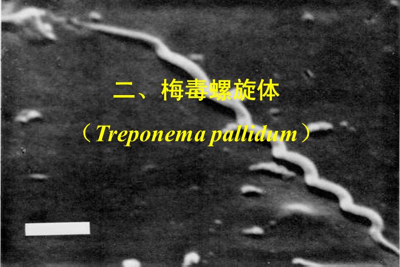 【醫學PPT課件】第21章 螺旋體 醫學微生物學教學課件第15頁