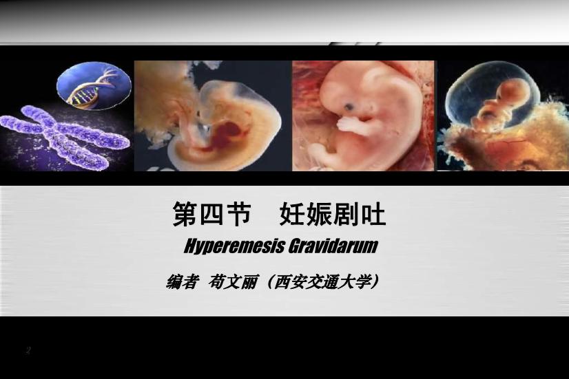 【醫學PPT課件】妊娠劇吐 人衛版教學PPT課件第4頁