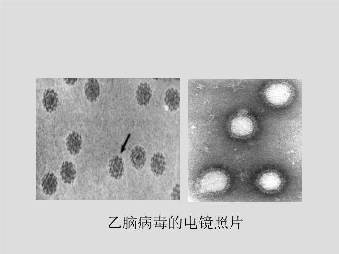 【醫學PPT課件】第28章 黃病毒 江蘇大學第10頁