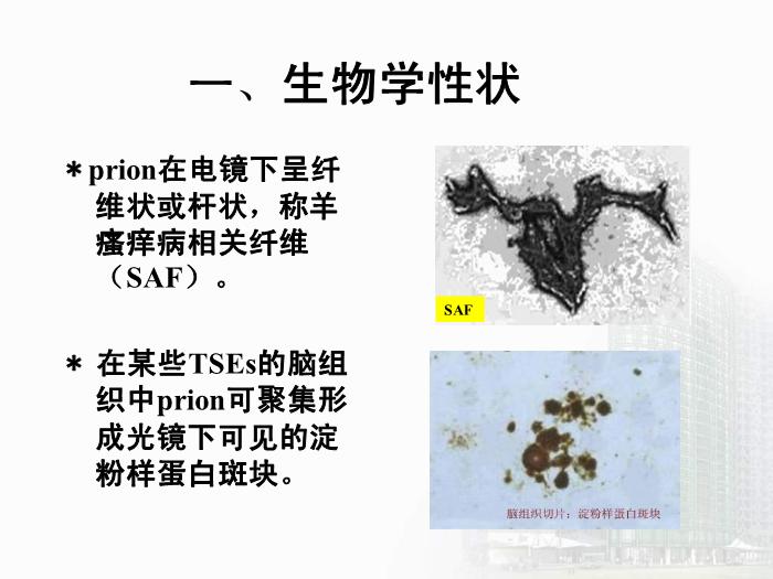 【醫學PPT課件】第34章 朊粒 醫學微生物學教學課件第6頁