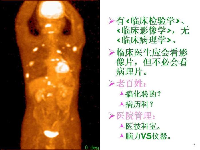 【醫學PPT課件】骨腫瘤病理知識  煤炭總醫院病理科楊連君第4頁